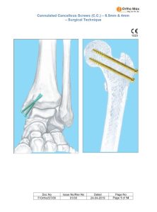Cannulated Cancellous Screws System- 4mm & 6mm Surgical Techniques