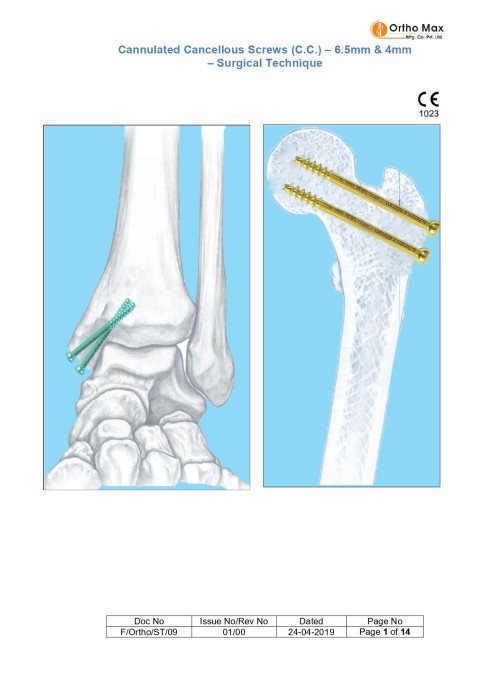 Cannulated Cancellous Screws System- 4mm & 6