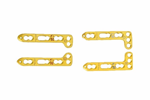 Dorsal Distal Radius Locking Plates L-90ᵒ Angled