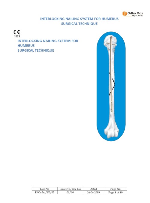 Interlocking Nailing System for Humerus