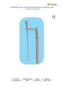 Interlocking Nailing System for IMSC Surgical Techniques
