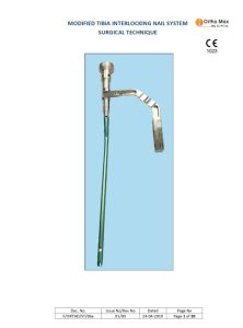 Interlocking Nailing System for Modified Tibia Surgical Techniques