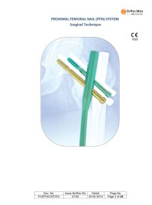 Interlocking Nailing System for Proximal Femoral Nail​ Surgical Techniques