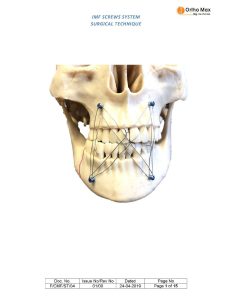 Intermaxillary Fixation system OrthoMax® Mfg Pvt ltd