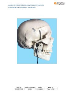 Intra Oral Ramus Distraction System Surgical Techniques