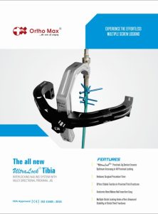 NEW UltraLock Tibia Catalogue