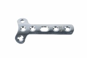 T Plate for Distal Radius Orthopaedic Fracture Fixation Implant