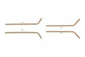 Titanium ultralock® mandibular Reconstruction Plates - Single Angle Secondary