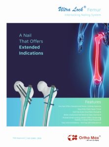 Ultralock Femur Nailing System Catalogue