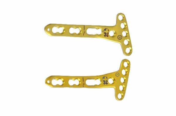 Volar Distal Radius Locking Plates Juxta-Articular