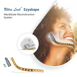 Ultra Lock® Ezyshape Mandibular Reconstruction System