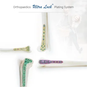Orthopaedics Ultra Lock® Plating System