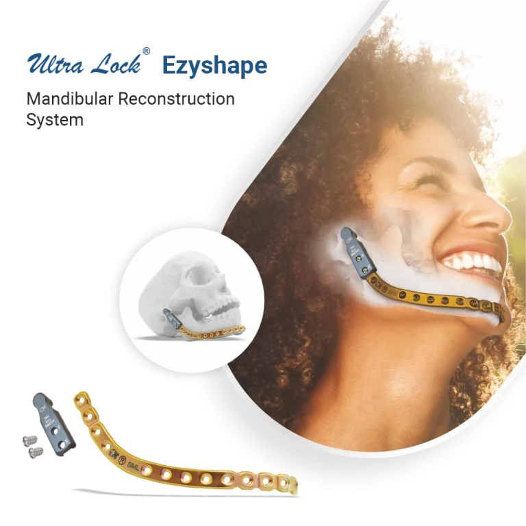ultra Lock EZYshape mandibular reconstruction System