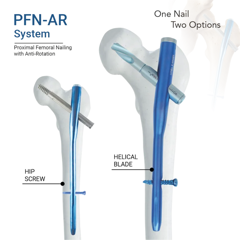 PFR-AR System