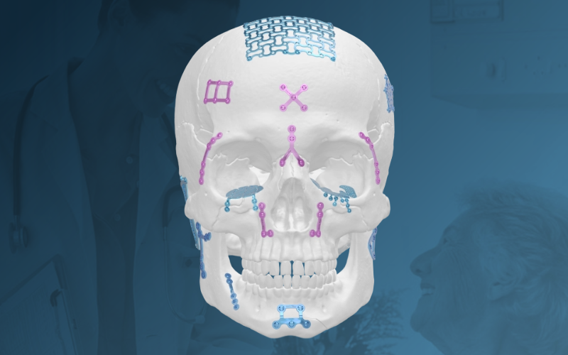 Cranio-Maxillofacial (CMF)Systems