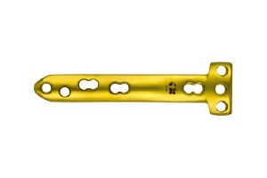 Medial High Tibial Osteotomy Locking Plate MHTO Orthopaedic Knee Osteotomy Implant