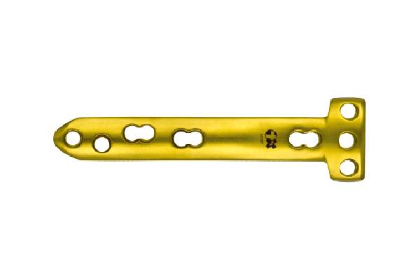 Medial High Tibial Osteotomy Locking plates(MHTO)