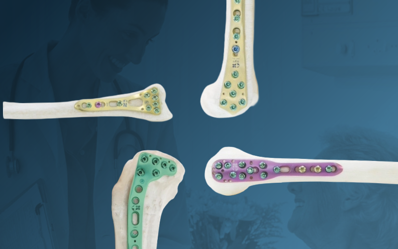 Orthopaedic Implants System