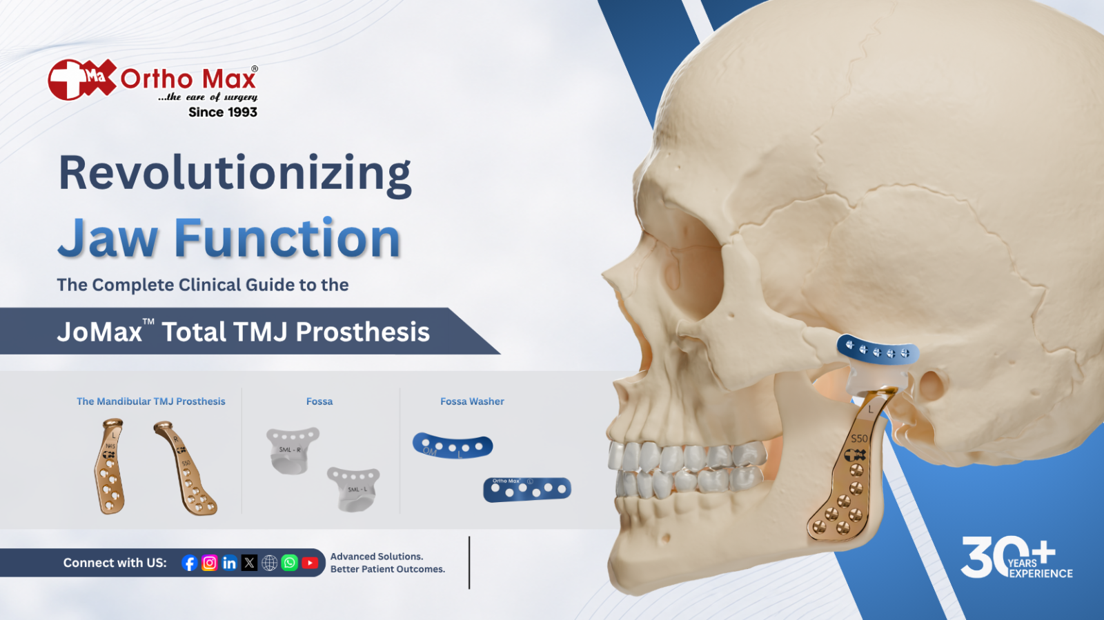 Revolutionizing Jaw Function: The Complete Clinical Guide to the JomaxTM Total TMJ Prosthesis