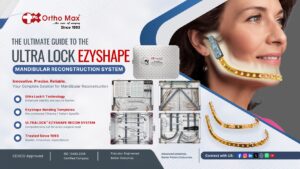 The Ultimate Guide to the Ultra Lock Ezyshape Mandibular Reconstruction System