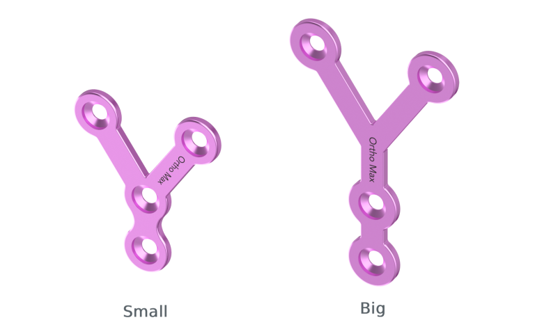 Titanium Y shape Plates Small - big
