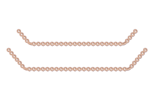 Titanium ultralock® mandibular Reconstruction Plates - Double Angle Secondary