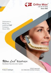 ULTRALOCK_EzyShape_Catalogue Mandibular Reconstruction system
