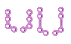 Upper Face Plating System - 1.5mm (2)-min