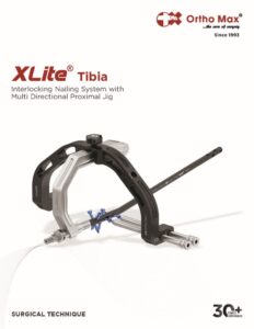 XLITE TIBIA SURGICAL TECHNIQUE R11 Page 01 OrthoMax® Mfg Co Pvt ltd