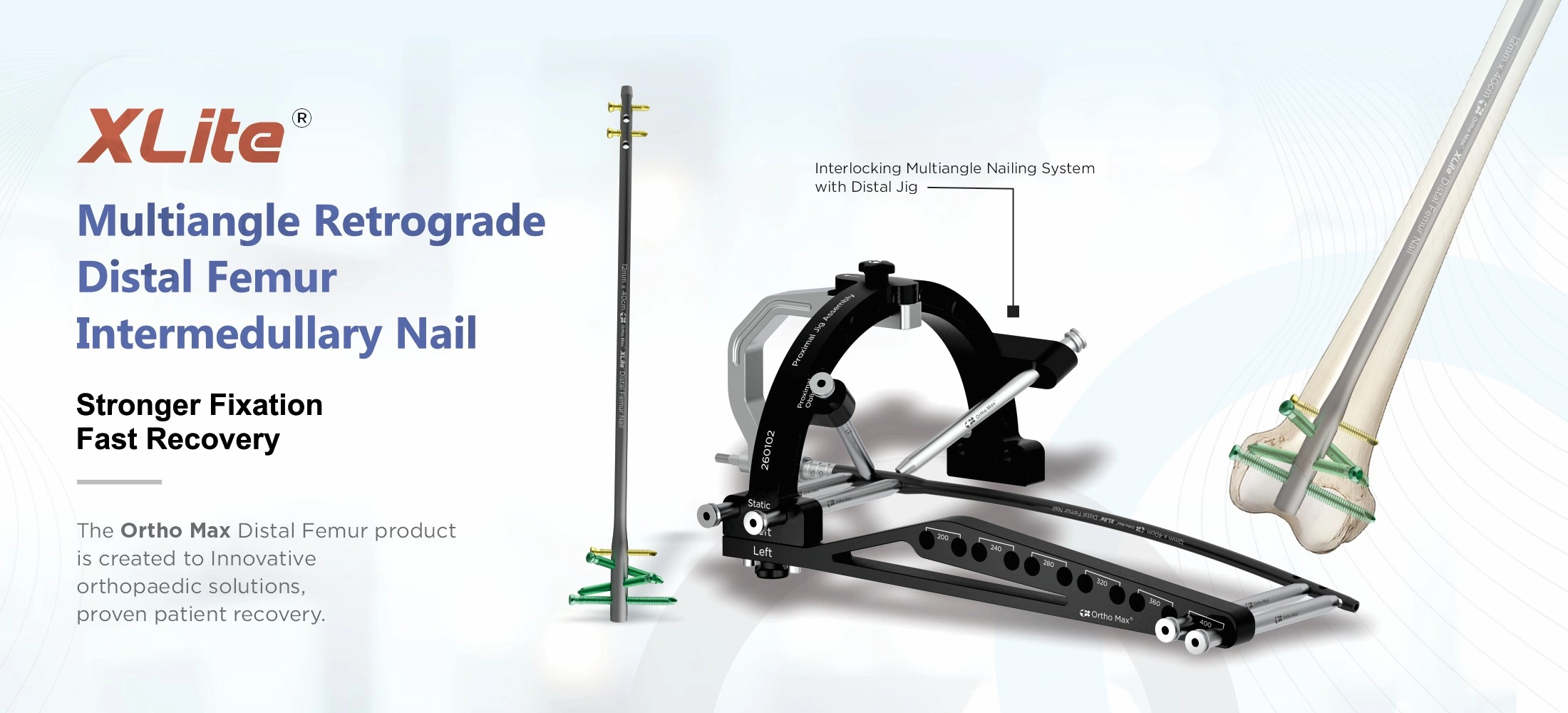 Xlite Interlocking Multiangle Nailing Cover