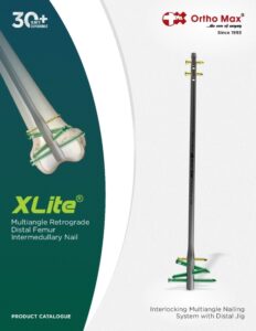 Xlite Multiangle Retrograde Femur Nail Calatogue cover OrthoMax® Mfg Co Pvt ltd