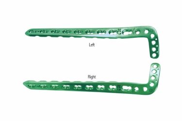Anterolateral Distal Tibia Locking Plates
