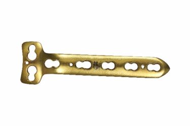 Buttress 'T' Locking Plates