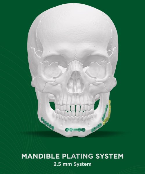 Mandible Plating system 2.5mm