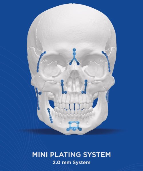 Mini Plating system 2.0 mm