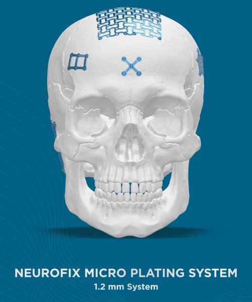 Neurofix Micro plating system 1.2mm