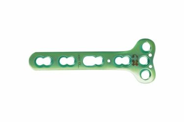 ' Locking Plates For Distal Radius - 3.5mm + 4mm Holes Combination