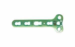 ' Locking Plates For Distal Radius - 3.5mm + 4mm Holes Combination