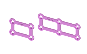 Titanium 3D Plates 1.5mm CMF Upper Face Plating System Orthopaedic Implant
