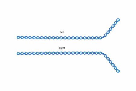 Titanium ultralock® mandibular Reconstruction Plates - Single Angle Regular