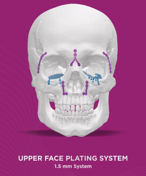 Upper Face Plating System 1.5mm