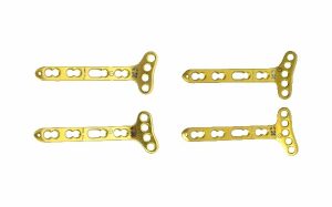 Volar Distal Radius Locking Plates Extra-Articular