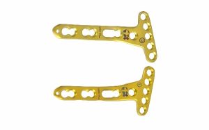 Volar Distal Radius Locking Plates Juxta-Articular